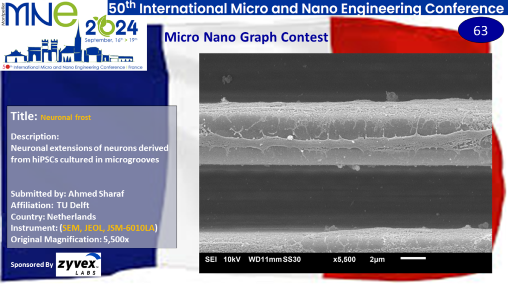 "Neuronal frost", A micrograph contest entry submitted by Ahmed Sharaf from TU Delft in the Netherlands.